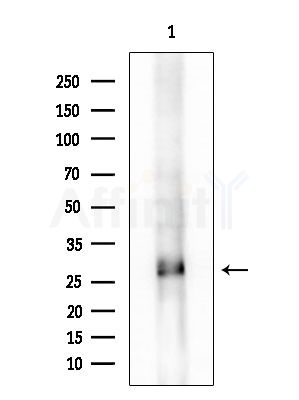 RAB19 Antibody - Western blot analysis of extracts from B16F10-LUC cells(starvation treatment), using RAB19 Antibody at 1/1000 dilution.