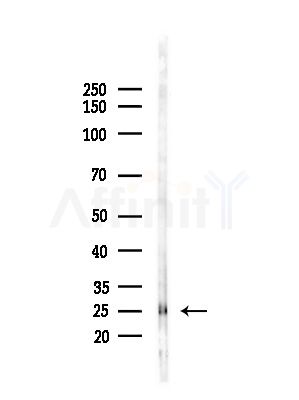 RAB19 Antibody - Western blot analysis of lysates from B16F10-LUC cells(starvation,24h treatment), using RAB19 Antibody at 1/1000 dilution.