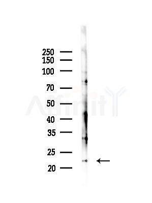 RAB1B Antibody - Western blot analysis of lysates from COLO205 cells(heat-shock,45min treatment), using RAB1B Antibody at 1/1000 dilution.