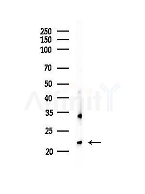 RAB1B Antibody - Western blot analysis of lysates from Hela cells(starvation,24h treatment), using RAB1B Antibody at 1/1000 dilution.