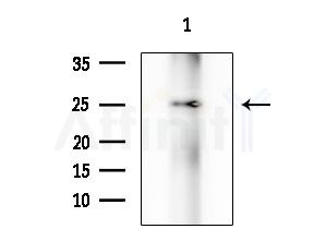 RAB28 Antibody - Western blot analysis of extracts from Mouse testis, using RAB28 Antibody at 1/1000 dilution.