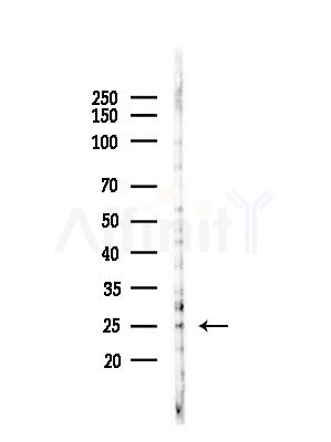 RAB28 Antibody - Western blot analysis of lysates from Mouse testis, using RAB28 Antibody at 1/1000 dilution.
