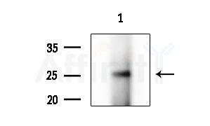 RAB30 Antibody - Western blot analysis of extracts from B16F10-LUC cells(starvation treatment), using RAB30 Antibody at 1/1000 dilution.
