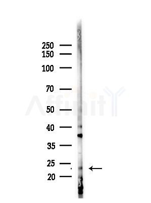 RAB30 Antibody - Western blot analysis of lysates from B16F10-LUC cells(starvation,24h treatment), using RAB30 Antibody at 1/1000 dilution.