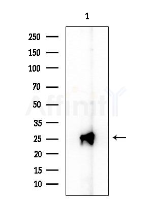 RAB32 Antibody - Western blot analysis of extracts from HepG2 cells(UV treatment), using RAB32 Antibody at 1/1000 dilution.