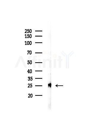 RAB32 Antibody - Western blot analysis of lysates from HepG2 cells(UV,30min treatment), using RAB32 Antibody at 1/1000 dilution.
