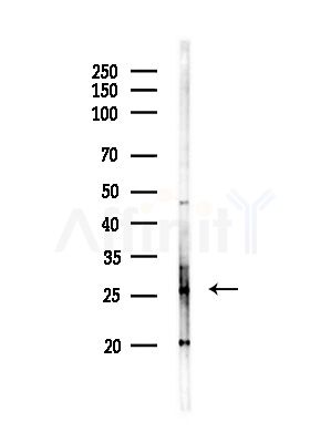 RAB33B Antibody - Western blot analysis of lysates from Hela cells(starvation,24h treatment), using RAB33B Antibody at 1/1000 dilution.