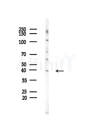 RAB36 Antibody - Western blot analysis of lysates from Hela cells(starvation,24h treatment), using RAB36 Antibody at 1/1000 dilution.