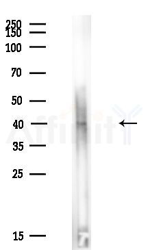 RAB39A Antibody - Western blot analysis of lysates from Rat liver, using RAB39A Antibody at 1/1000 dilution.