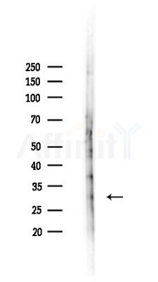 RAB40A/L Antibody - Western blot analysis of lysates from HepG2 cells(heat-shock,45min treatment), using RAB40A/L Antibody at 1/1000 dilution.
