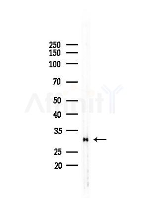 RAB40C Antibody - Western blot analysis of lysates from LoVo cells(heat-shock,45min treatment), using RAB40C Antibody at 1/1000 dilution.