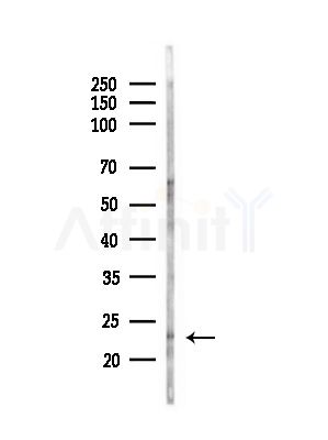 RAB43 Antibody - Western blot analysis of lysates from Hela cells(heat-shock,45min treatment), using RAB43 Antibody at 1/1000 dilution.
