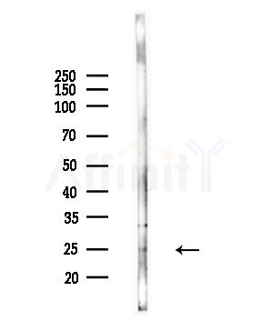 RAB5B Antibody - Western blot analysis of lysates from Hela cells(UV,30min treatment), using RAB5B Antibody at 1/1000 dilution.