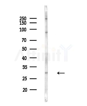 RAB5B Antibody - Western blot analysis of lysates from COLO205 cells(UV,30min treatment), using RAB5B Antibody at 1/1000 dilution.
