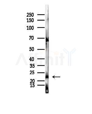 RRAS2 Antibody - Western blot analysis of lysates from Mouse lung, using RRAS2 Antibody at 1/1000 dilution.