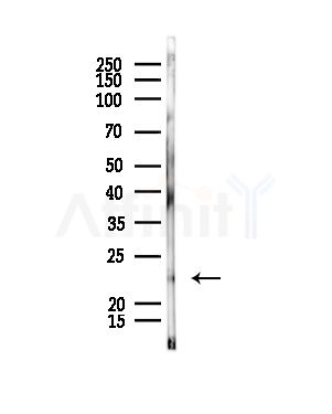 RRAS2 Antibody - Western blot analysis of lysates from Rat liver, using RRAS2 Antibody at 1/1000 dilution.