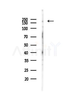 PTPRK Antibody - Western blot analysis of lysates from EC304 cells(heat-shock,45min treatment), using PTPRK Antibody at 1/1000 dilution.