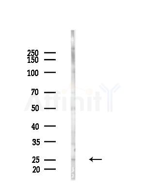 RGS17 Antibody - Western blot analysis of lysates from Hela cells(starvation,24h treatment), using RGS17 Antibody at 1/1000 dilution.