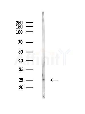 RGS17 Antibody - Western blot analysis of lysates from HepG2 cells(LPS, 4h treatment), using RGS17 Antibody at 1/1000 dilution.