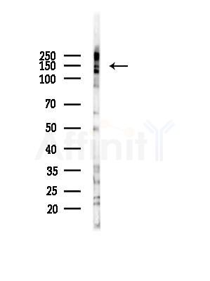 RGS22 Antibody - Western blot analysis of lysates from HepG2 cells(LPS, 4h treatment), using RGS22 Antibody at 1/1000 dilution.