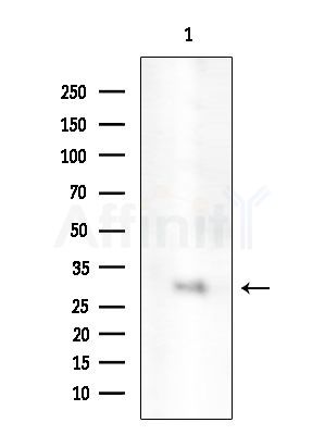 RGS4 Antibody - Western blot analysis of extracts from EC304 cells, using RGS4 Antibody at 1/1000 dilution.
