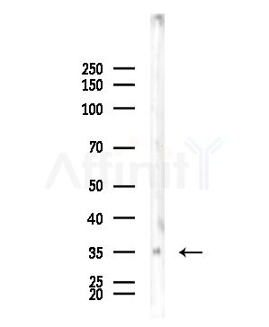 RGS4 Antibody - Western blot analysis of lysates from EC304 cells, using RGS4 Antibody at 1/1000 dilution.