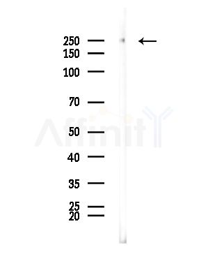 ABCA4 Antibody - Western blot analysis of lysates from EC304 cells, using ABCA4 Antibody at 1/1000 dilution.