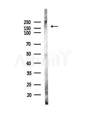 RBBP6 Antibody - Western blot analysis of lysates from Hela cells(heat-shock,45min treatment), using RBBP6 Antibody at 1/1000 dilution.