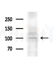RHG4 Antibody - Western blot analysis of extracts from various samples, using RHG4 Antibody at 1/1000 dilution.