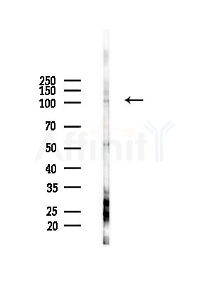 RHG4 Antibody - Western blot analysis of lysates from HepG2 cells(LPS,4h treatment), using RHG4 Antibody at 1/1000 dilution.