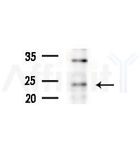 RHOF Antibody - Western blot analysis of extracts from various samples, using RHOF Antibody at 1/1000 dilution.