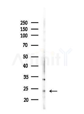 RHOF Antibody - Western blot analysis of lysates from HepG2 cells(LPS, 4h treatment), using RHOF Antibody at 1/1000 dilution.