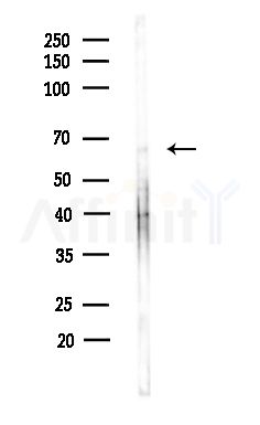 RTKN Antibody - Western blot analysis of lysates from Hela cells(heat-shock,45min treatment), using RTKN Antibody at 1/1000 dilution.
