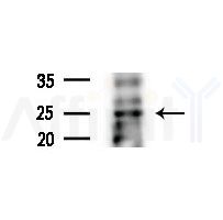 RHOXF1 Antibody - Western blot analysis of extracts from various samples, using RHOXF1 Antibody at 1/1000 dilution.