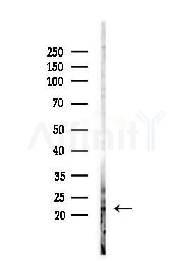 RHOXF1 Antibody - Western blot analysis of lysates from HepG2 cells(LPS, 4h treatment), using RHOXF1 Antibody at 1/1000 dilution.