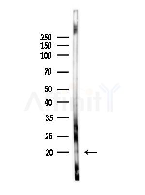 RPL22/L1 Antibody - Western blot analysis of lysates from PC12 cells, using RPL22/L1 Antibody at 1/1000 dilution.