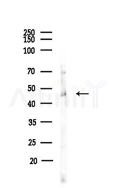 SEPT11 Antibody - Western blot analysis of lysates from MCF7 cells(heat-shock,45min treatment), using SEPT11 Antibody at 1/1000 dilution.