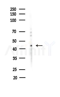 SEPT11 Antibody - Western blot analysis of lysates from Hela cells(heat-shock,45min treatment), using SEPT11 Antibody at 1/1000 dilution.