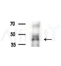 SEPT5 Antibody - Western blot analysis of lysates from various samples, using SEPT5 Antibody at 1/1000 dilution.