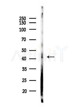 SEPT5 Antibody - Western blot analysis of lysates from PC12 cells(LPS, 4h treatment), using SEPT5 Antibody at 1/1000 dilution.