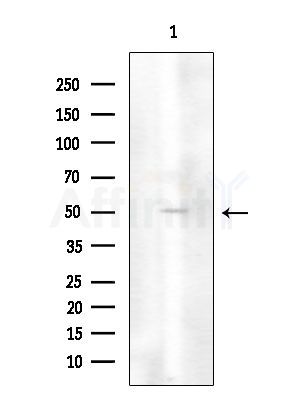 STK38L Antibody - Western blot analysis of extracts from COLO205 cells, using STK38L Antibody at 1/1000 dilution.