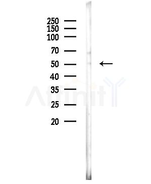 STK38L Antibody - Western blot analysis of lysates from COLO205 cells, using STK38L Antibody at 1/1000 dilution.