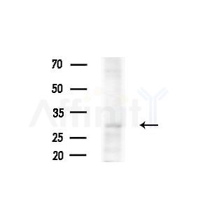 PIM2 Antibody - Western blot analysis of extracts from HepG2 cells(starvation,24h treatment), using PIM2 Antibody at 1/1000 dilution.