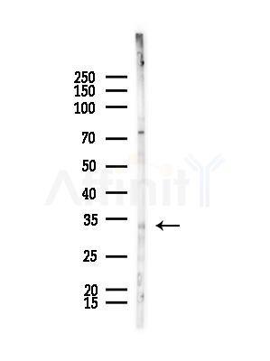 PIM2 Antibody - Western blot analysis of lysates from HepG2 cells(starvation,24h treatment), using PIM2 Antibody at 1/1000 dilution.