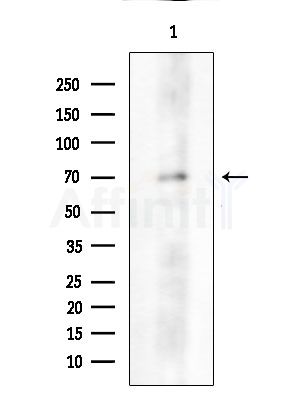 RIOK1 Antibody - Western blot analysis of extracts from Mouse brain, using RIOK1 Antibody at 1/1000 dilution.