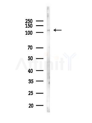 SRPK2 Antibody - Western blot analysis of lysates from PC12 cells(LPS, 4h treatment), using SRPK2 Antibody at 1/1000 dilution.