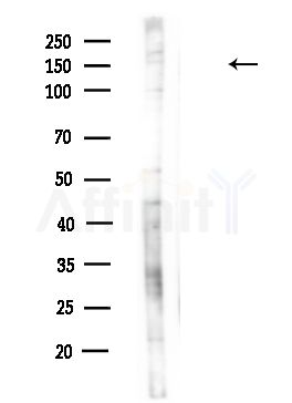 ULK4 Antibody - Western blot analysis of lysates from HUVEC cells(UV,30min treatment), using ULK4 Antibody at 1/1000 dilution.