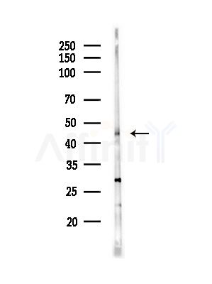 STAC3 Antibody - Western blot analysis of lysates from Hela cells(starvation,24h treatment), using STAC3 Antibody at 1/1000 dilution.