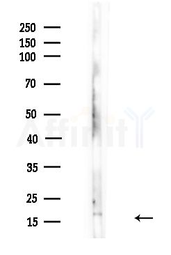 CCL18 Antibody - Western blot analysis of lysates from Mouse brain, using CCL18 Antibody at 1/1000 dilution.