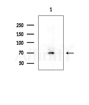 SLC6A18 Antibody - Western blot analysis of extracts from HepG2 cells(starvation treatment), using SLC6A18 Antibody at 1/1000 dilution.